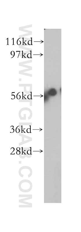 Western Blot (WB) analysis of HEK-293 cells using DAK Polyclonal antibody (12224-1-AP)