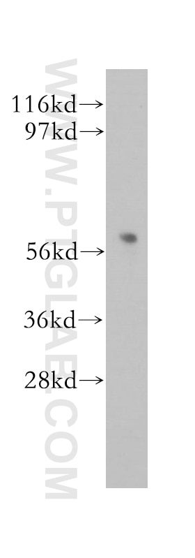 Western Blot (WB) analysis of mouse uterus tissue using DAK Polyclonal antibody (12224-1-AP)