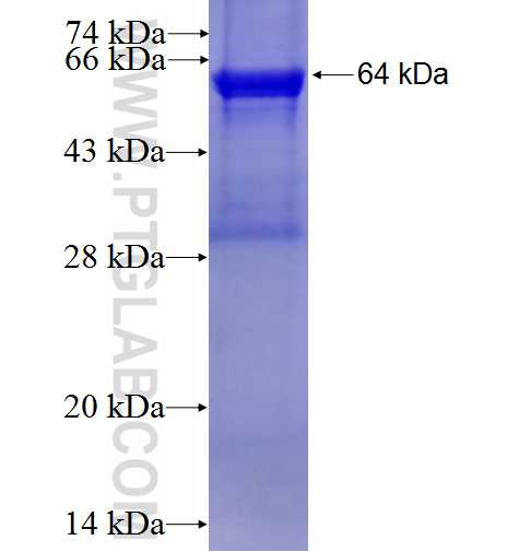 DAK fusion protein Ag2861 SDS-PAGE