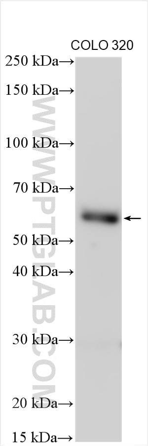 Western Blot (WB) analysis of COLO 320 cells using DALRD3 Polyclonal antibody (26294-1-AP)