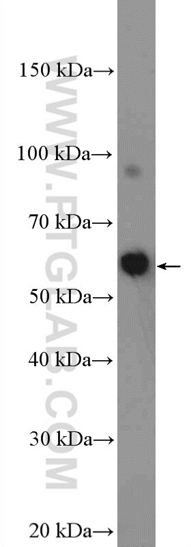 Western Blot (WB) analysis of K-562 cells using DALRD3 Polyclonal antibody (26294-1-AP)