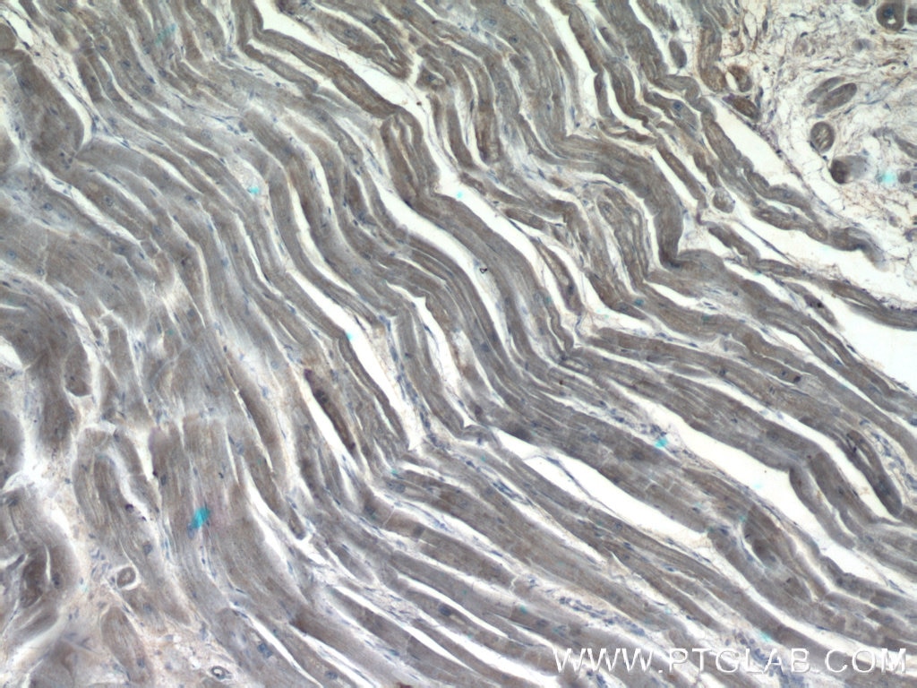 IHC staining of human heart using 22137-1-AP