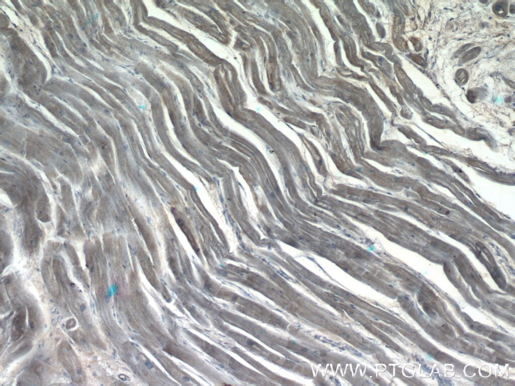 Immunohistochemistry (IHC) staining of human heart tissue using DAND5 Polyclonal antibody (22137-1-AP)