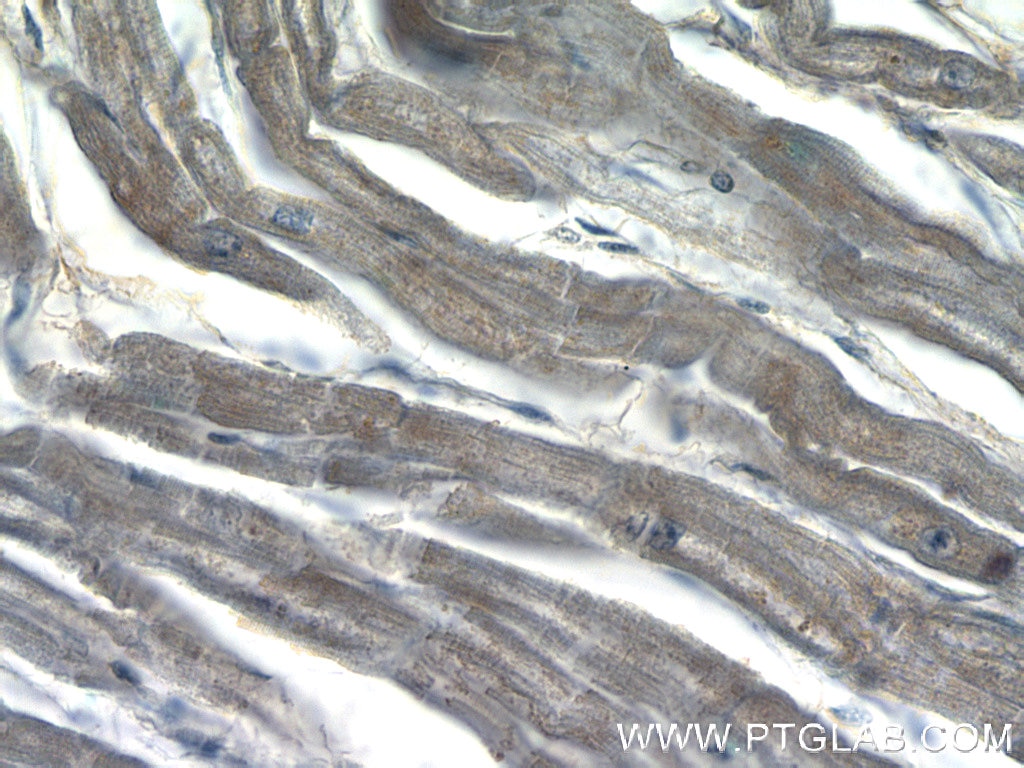 IHC staining of human heart using 22137-1-AP