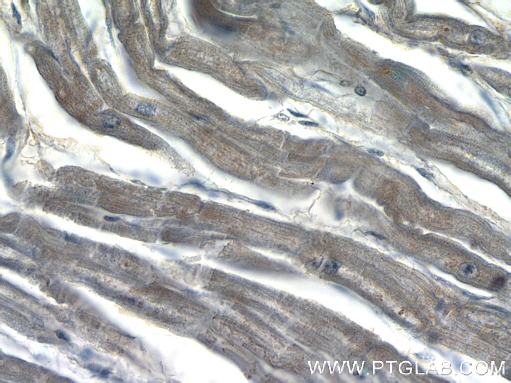 Immunohistochemistry (IHC) staining of human heart tissue using DAND5 Polyclonal antibody (22137-1-AP)