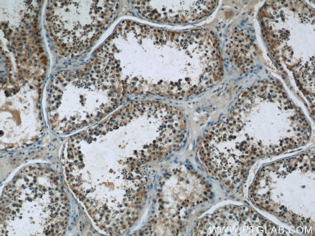 Immunohistochemistry (IHC) staining of human testis tissue using DAND5 Polyclonal antibody (22137-1-AP)