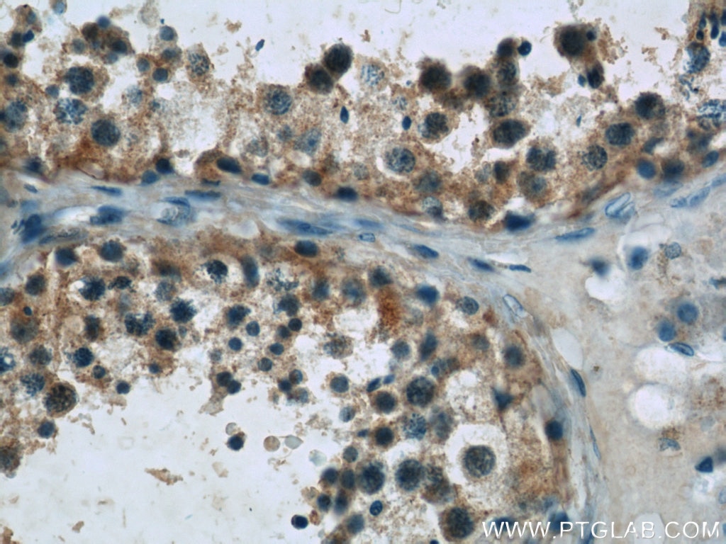 Immunohistochemistry (IHC) staining of human testis tissue using DAND5 Polyclonal antibody (22137-1-AP)