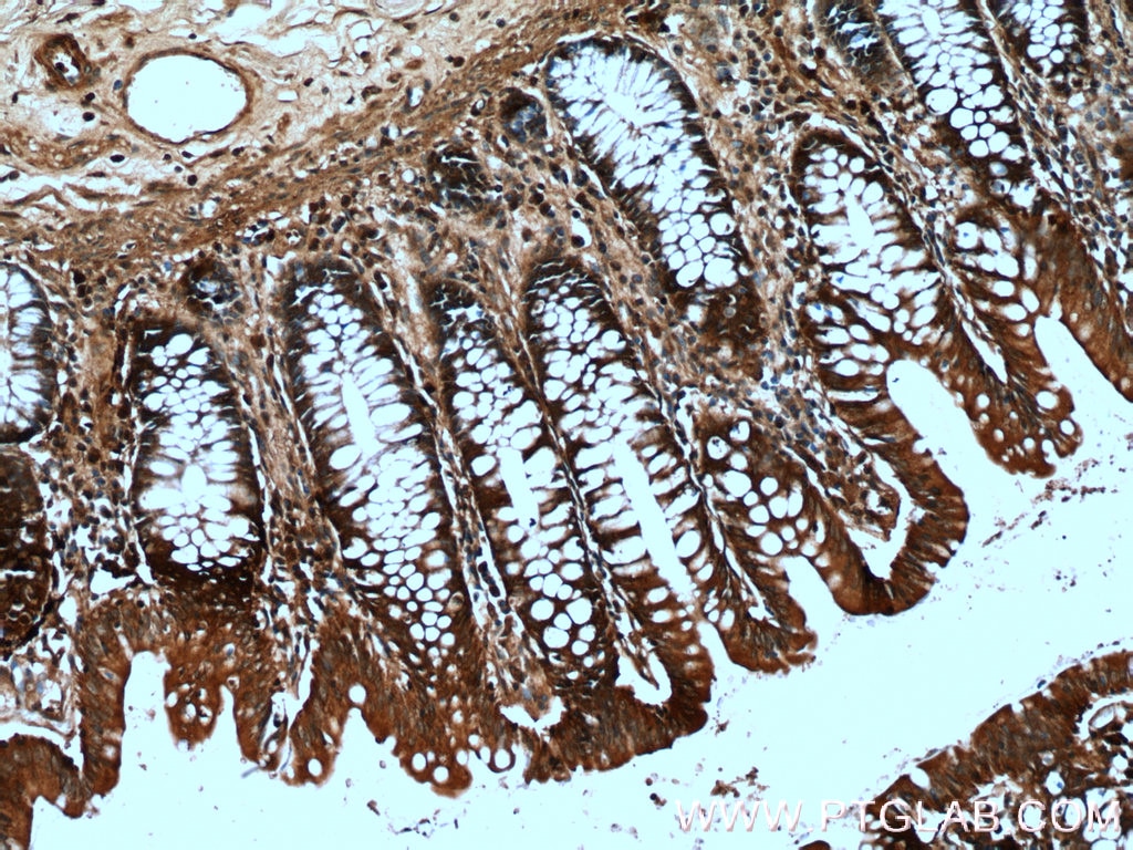 Immunohistochemistry (IHC) staining of human colon tissue using DAO Polyclonal antibody (13273-1-AP)