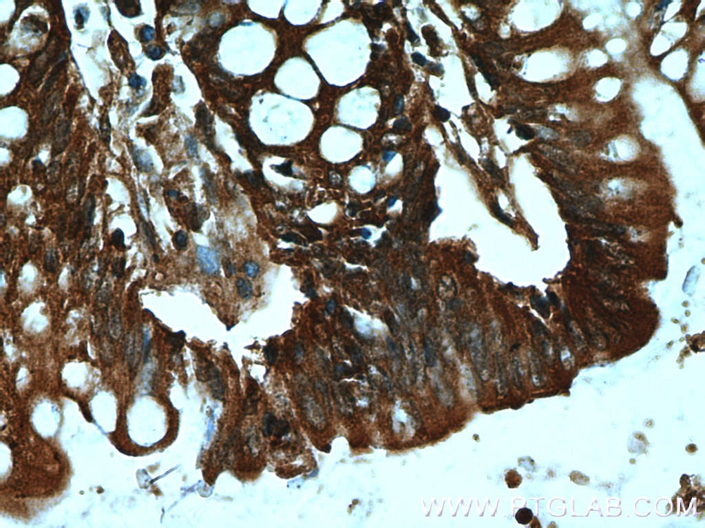 Immunohistochemistry (IHC) staining of human colon tissue using DAO Polyclonal antibody (13273-1-AP)