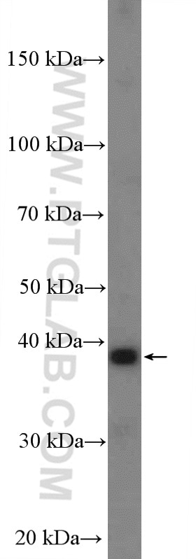 WB analysis of A549 using 13273-1-AP