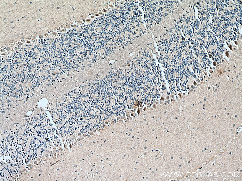 IHC staining of mouse cerebellum using 66296-1-Ig