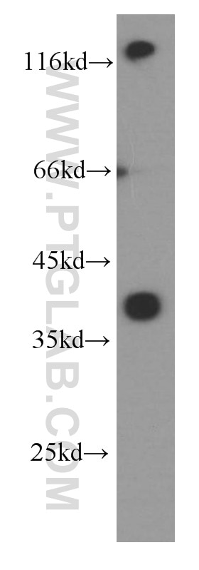 WB analysis of fetal human brain using 66296-1-Ig