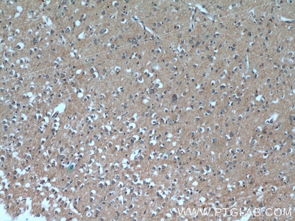 Immunohistochemistry (IHC) staining of human brain tissue using DAOA Polyclonal antibody (24692-1-AP)
