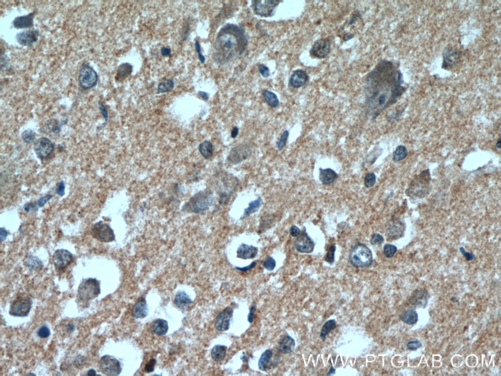 Immunohistochemistry (IHC) staining of human brain tissue using DAOA Polyclonal antibody (24692-1-AP)