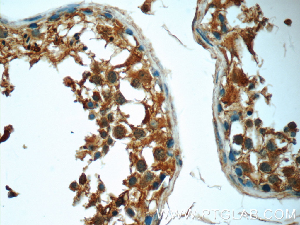 IHC staining of human testis using 24692-1-AP