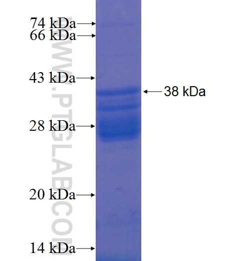 DAP fusion protein Ag0181 SDS-PAGE