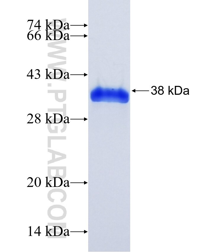 DAP fusion protein Ag0181 SDS-PAGE