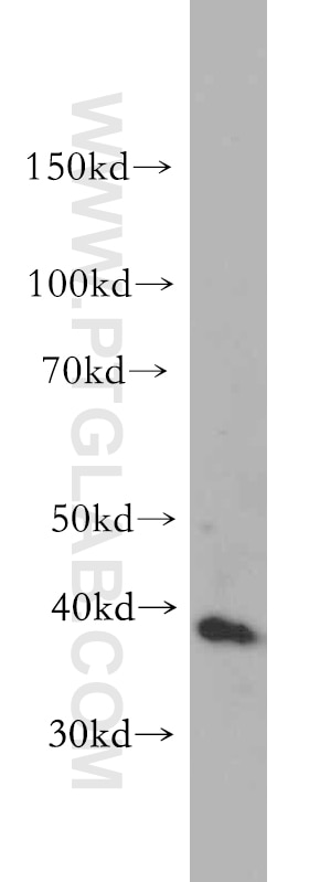 Western Blot (WB) analysis of human brain tissue using DAP3 Polyclonal antibody (10276-1-AP)