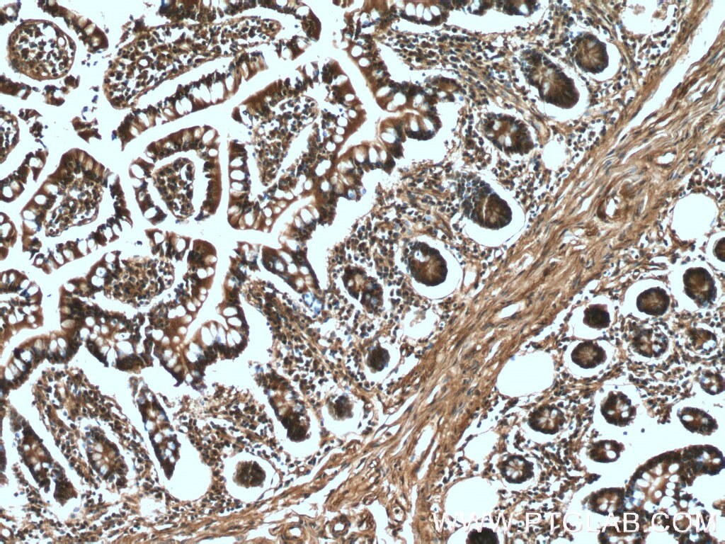 Immunohistochemistry (IHC) staining of human small intestine tissue using DAPK1 Polyclonal antibody (19938-1-AP)