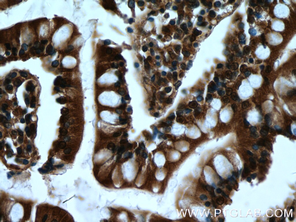 Immunohistochemistry (IHC) staining of human small intestine tissue using DAPK1 Polyclonal antibody (19938-1-AP)