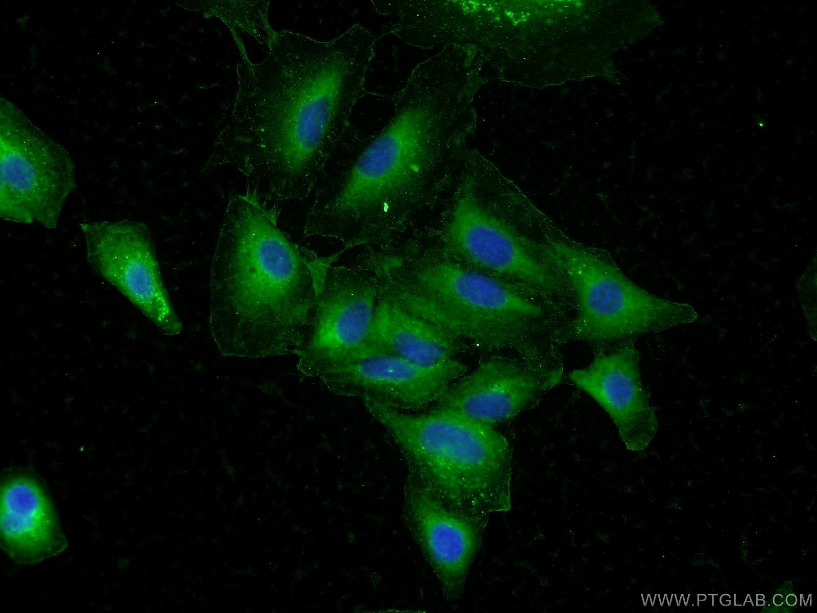 Immunofluorescence (IF) / fluorescent staining of A549 cells using DAPK1 Polyclonal antibody (25136-1-AP)