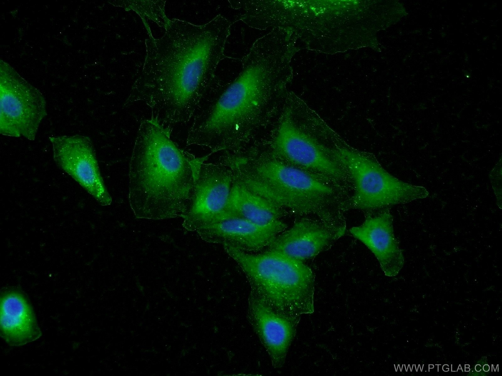 IF Staining of A549 using 25136-1-AP