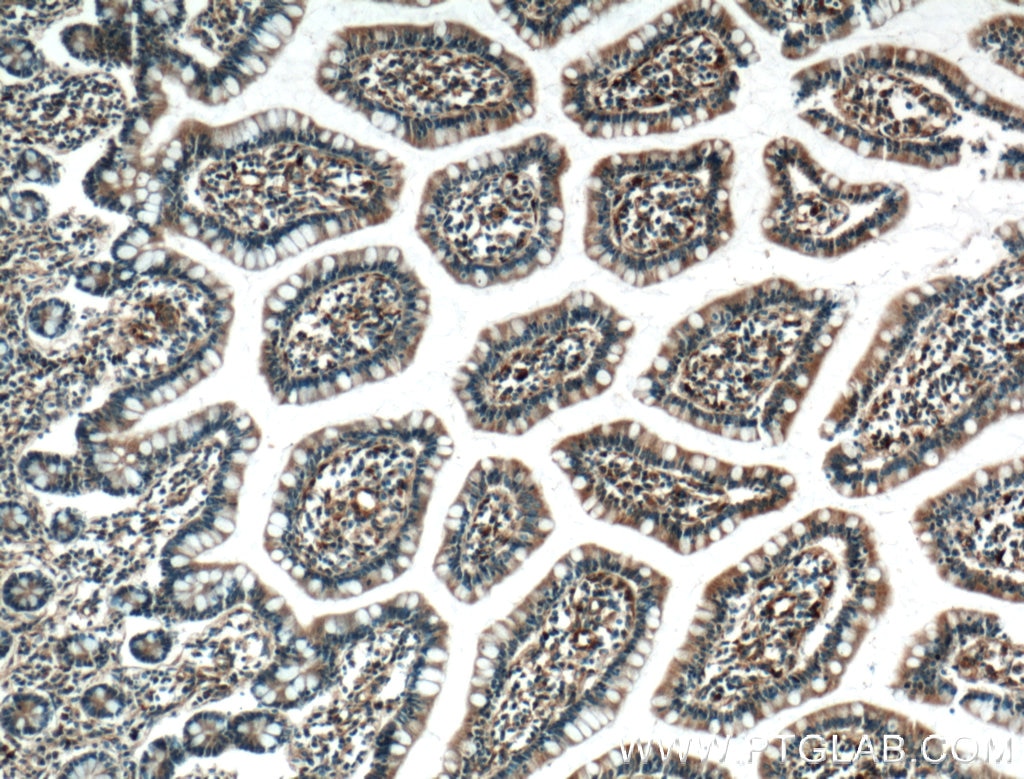 Immunohistochemistry (IHC) staining of human small intestine tissue using DAPK1 Polyclonal antibody (25136-1-AP)