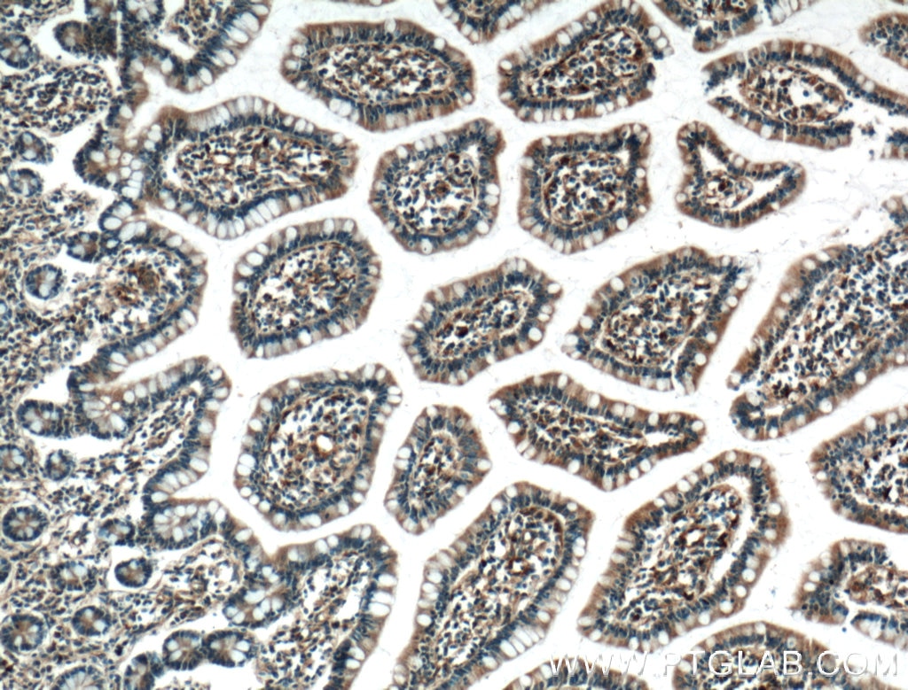 IHC staining of human small intestine using 25136-1-AP