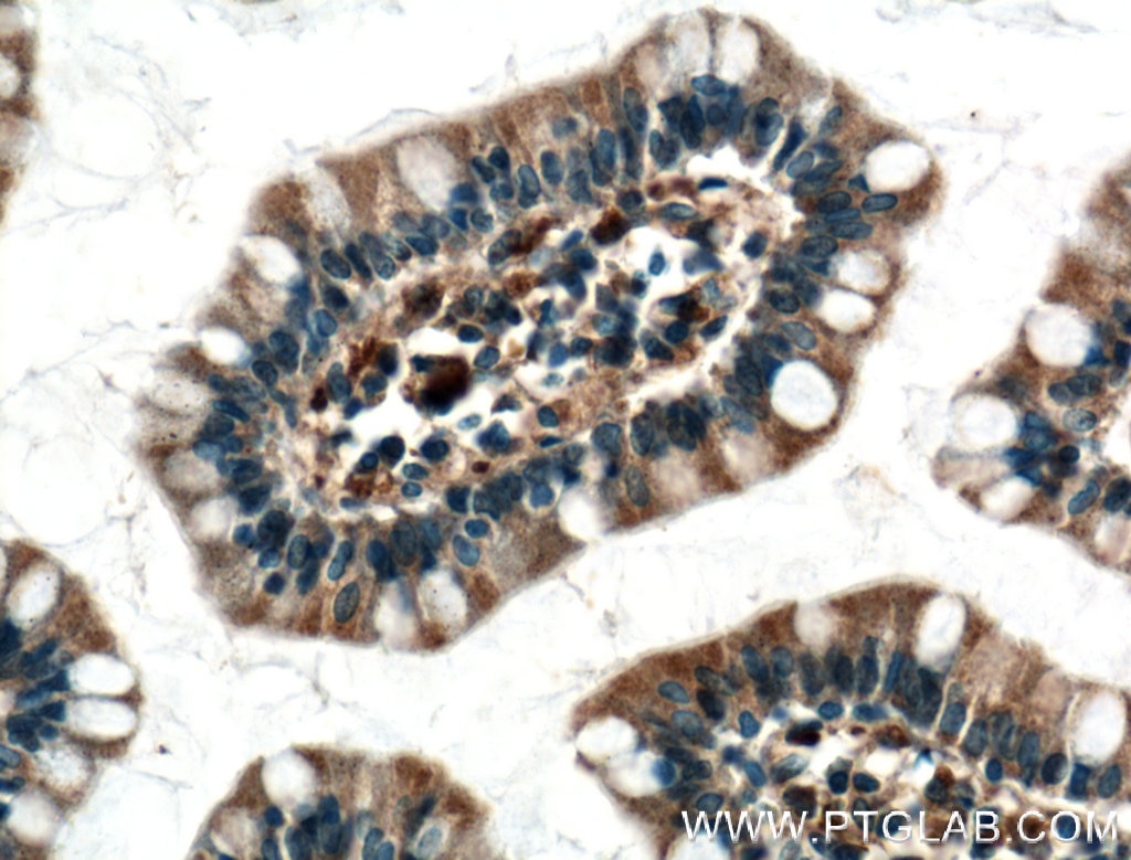 Immunohistochemistry (IHC) staining of human small intestine tissue using DAPK1 Polyclonal antibody (25136-1-AP)