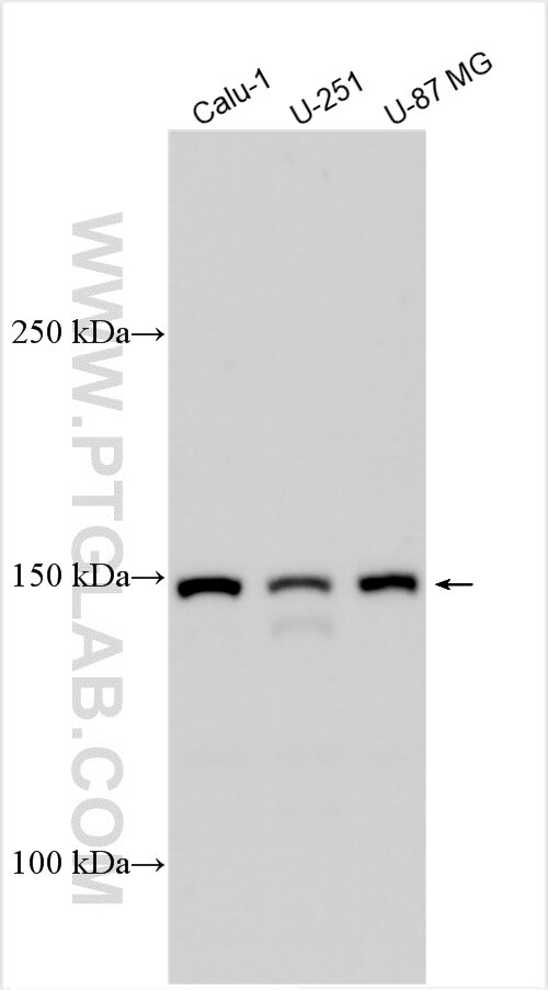 Western Blot (WB) analysis of various lysates using DAPK1 Polyclonal antibody (25136-1-AP)