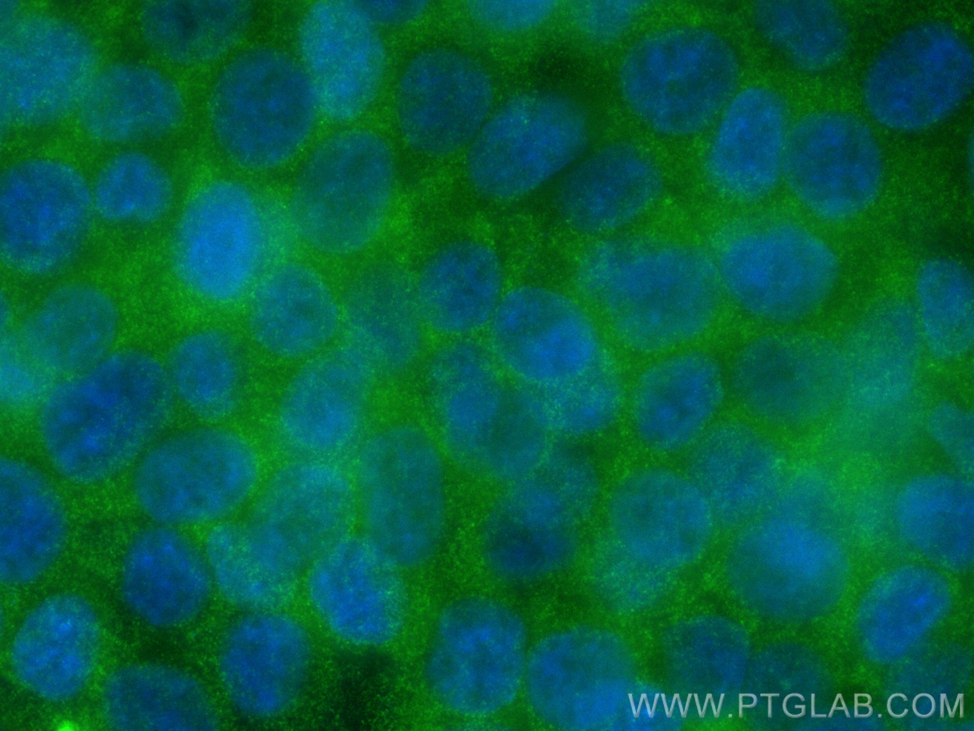 Immunofluorescence (IF) / fluorescent staining of HCT 116 cells using DAPK1 Monoclonal antibody (67815-1-Ig)