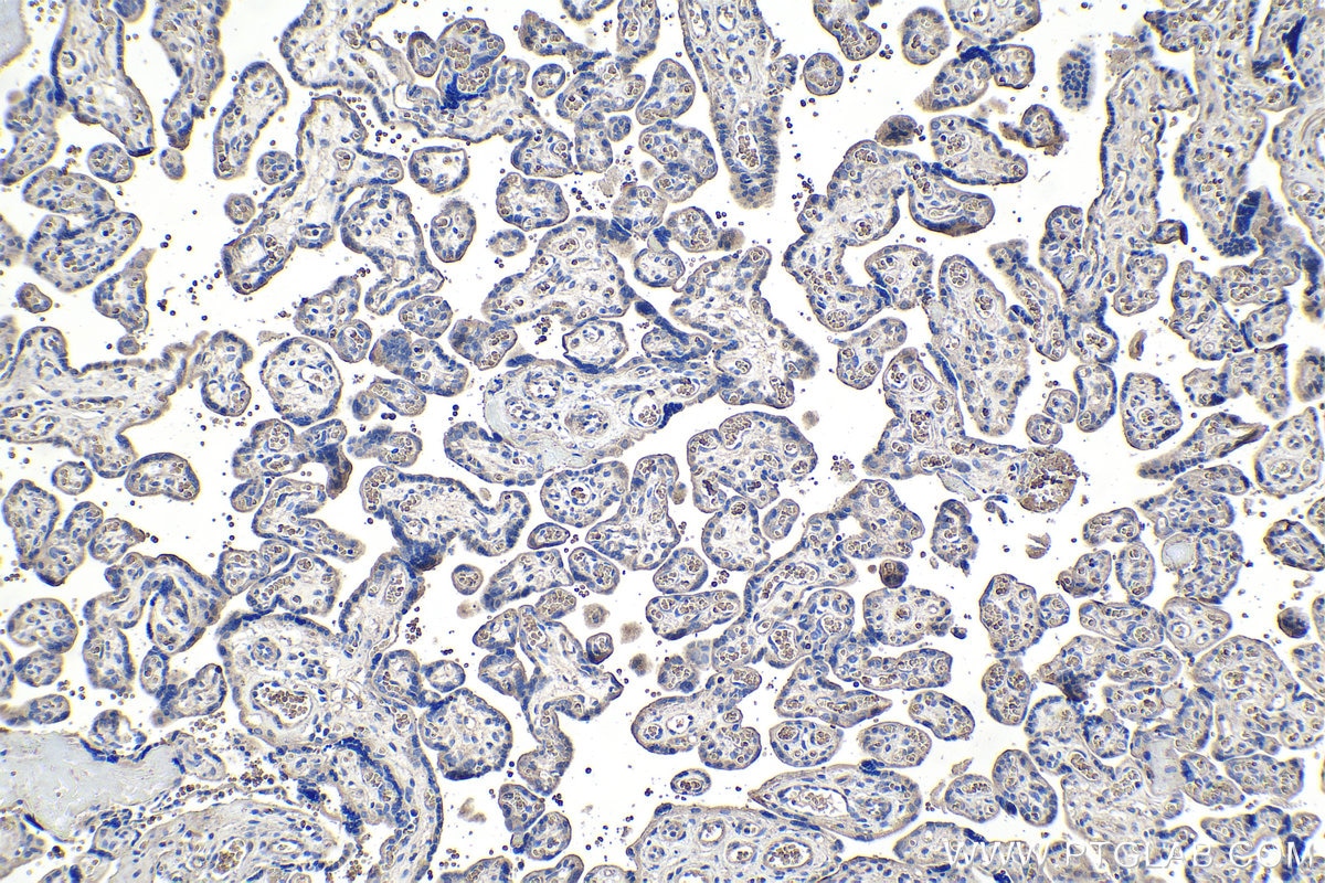 Immunohistochemistry (IHC) staining of human placenta tissue using DAPK1 Monoclonal antibody (67815-1-Ig)