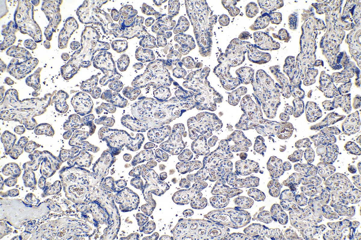 IHC staining of human placenta using 67815-1-Ig