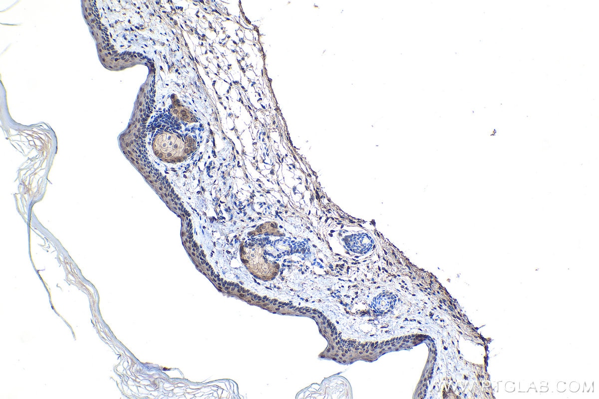 Immunohistochemistry (IHC) staining of mouse skin tissue using DAPK1 Monoclonal antibody (67815-1-Ig)