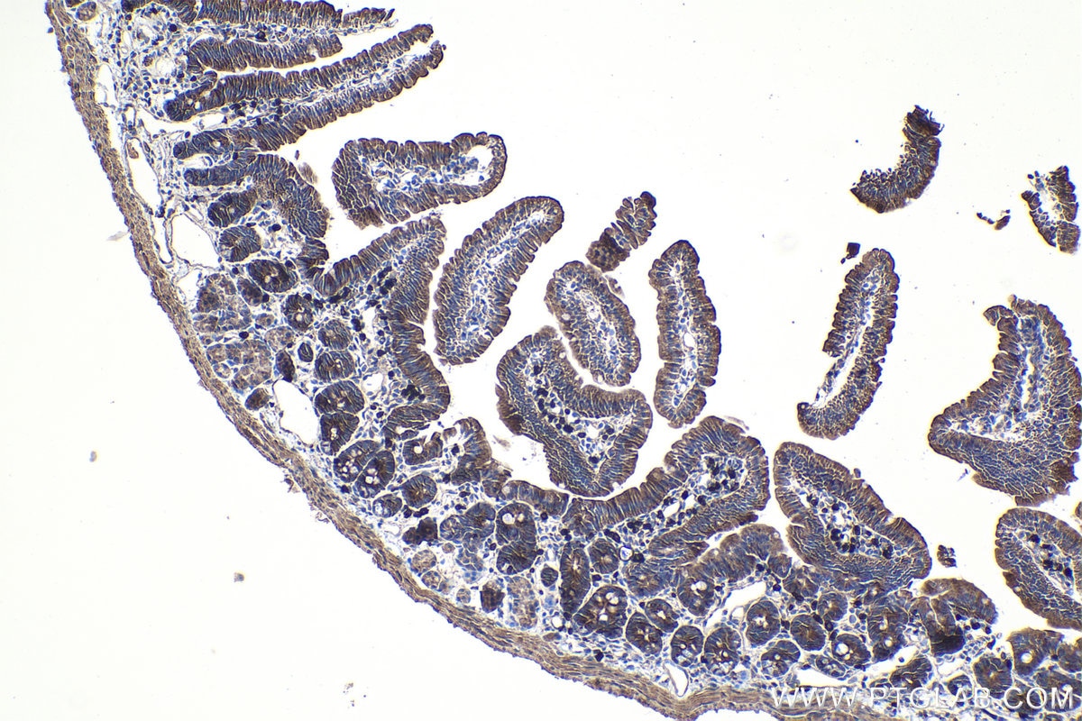 Immunohistochemistry (IHC) staining of mouse small intestine tissue using DAPK1 Monoclonal antibody (67815-1-Ig)