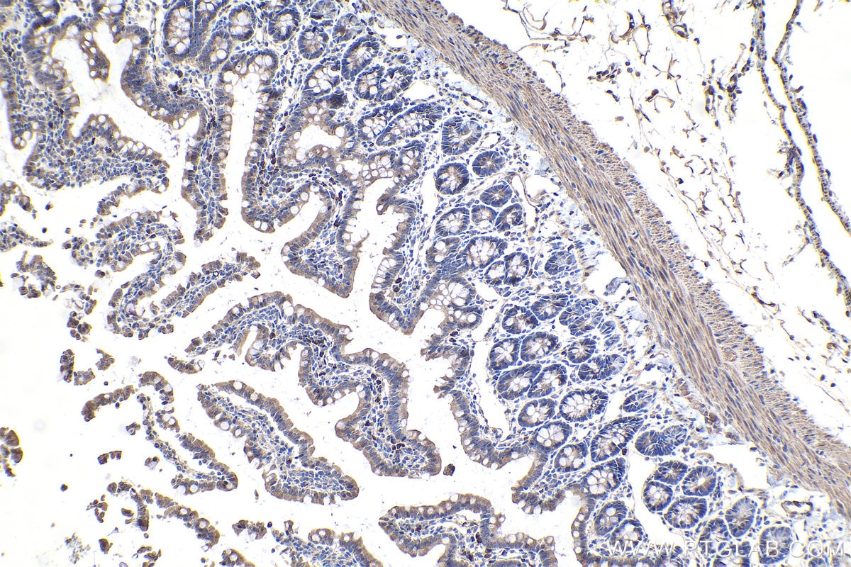 Immunohistochemistry (IHC) staining of rat small intestine tissue using DAPK1 Monoclonal antibody (67815-1-Ig)