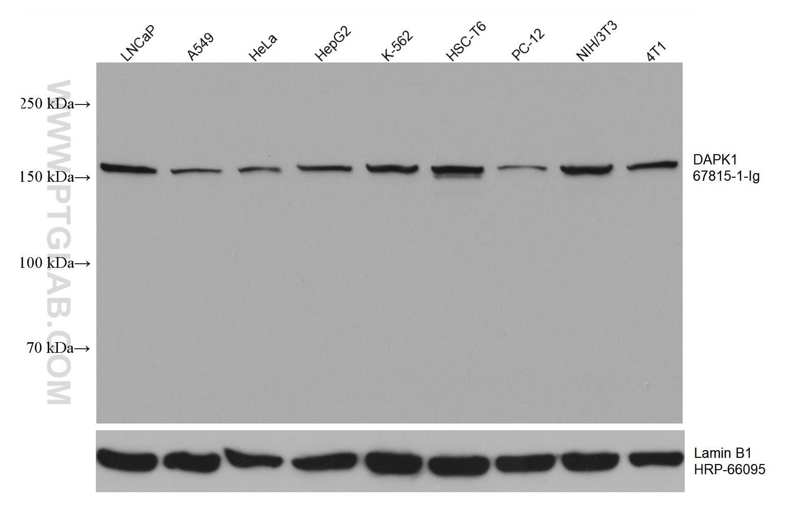 Western Blot (WB) analysis of various lysates using DAPK1 Monoclonal antibody (67815-1-Ig)
