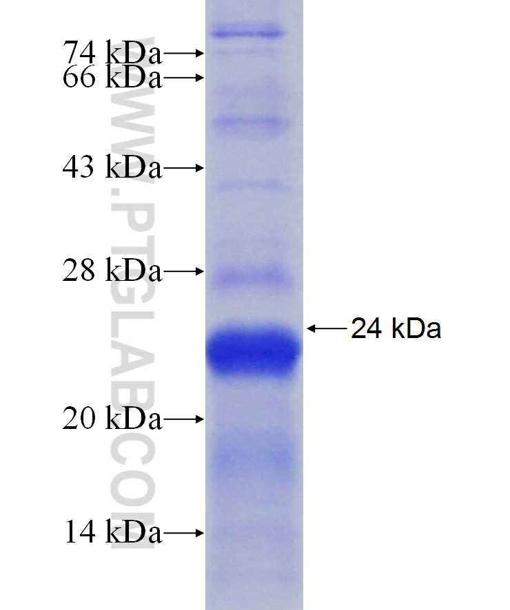 DAPK1 fusion protein Ag29838 SDS-PAGE