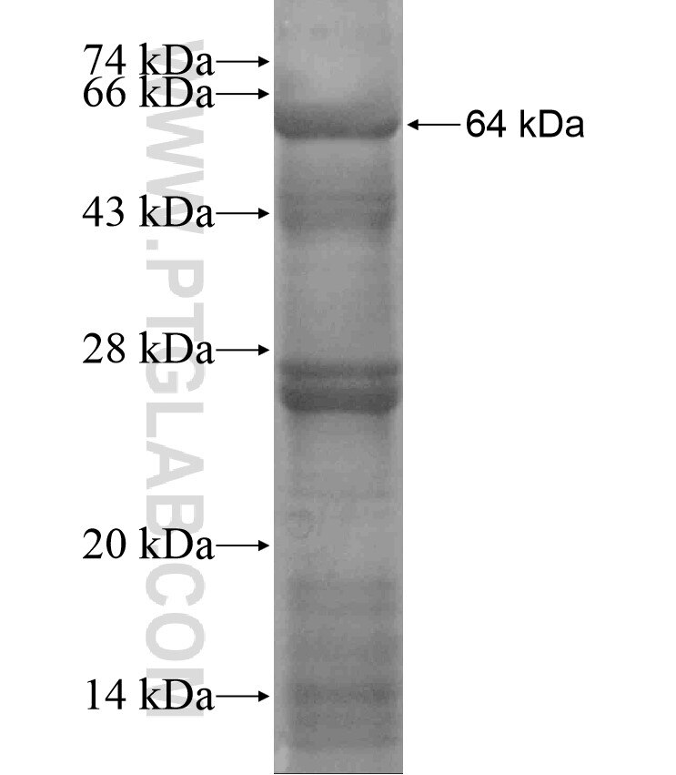 DAPK1 fusion protein Ag18006 SDS-PAGE