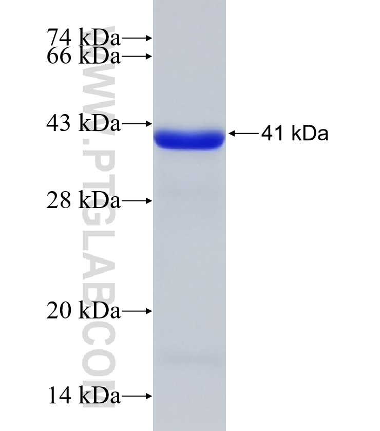 DAPK1 fusion protein Ag18387 SDS-PAGE