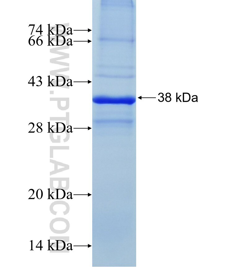 DAPK2 fusion protein Ag18105 SDS-PAGE