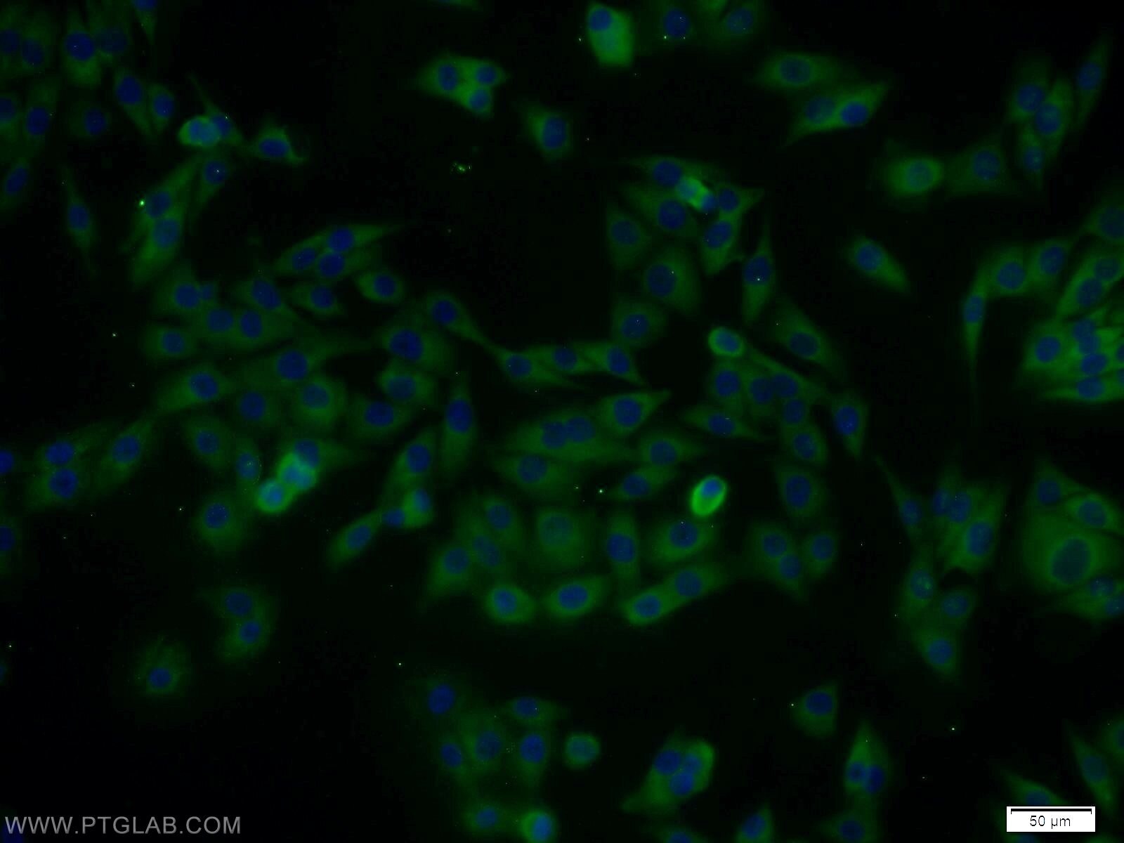 Immunofluorescence (IF) / fluorescent staining of A375 cells using DAPK2-Specific Polyclonal antibody (20048-1-AP)