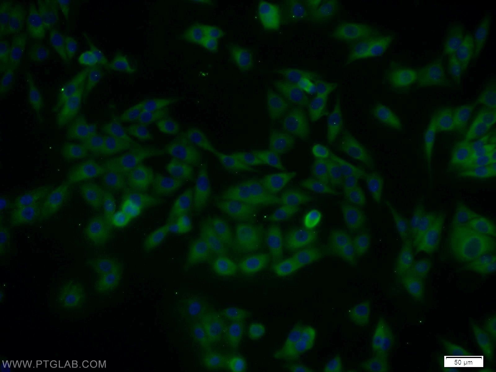 IF Staining of A375 using 20048-1-AP