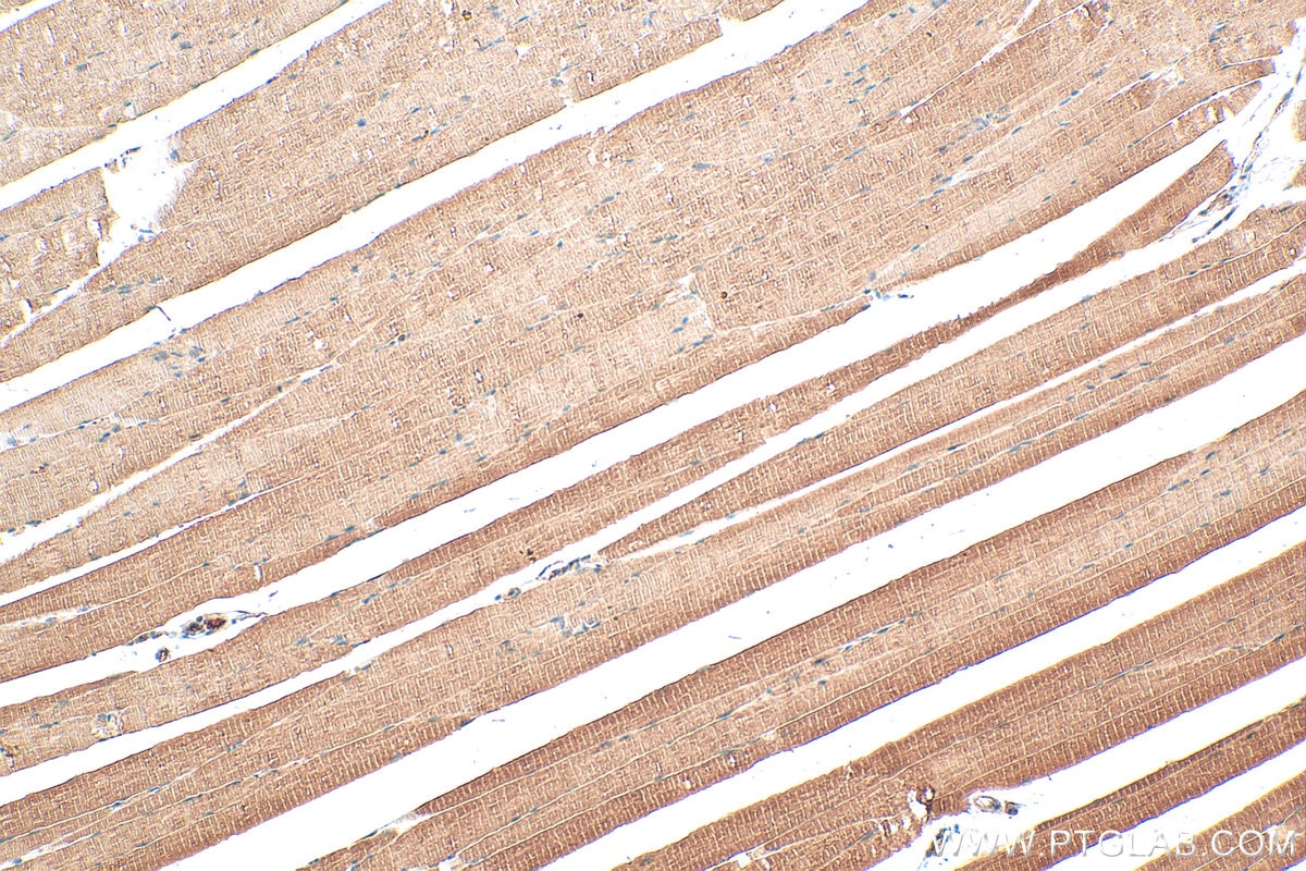 Immunohistochemistry (IHC) staining of mouse skeletal muscle tissue using DAPK2-Specific Polyclonal antibody (20048-1-AP)