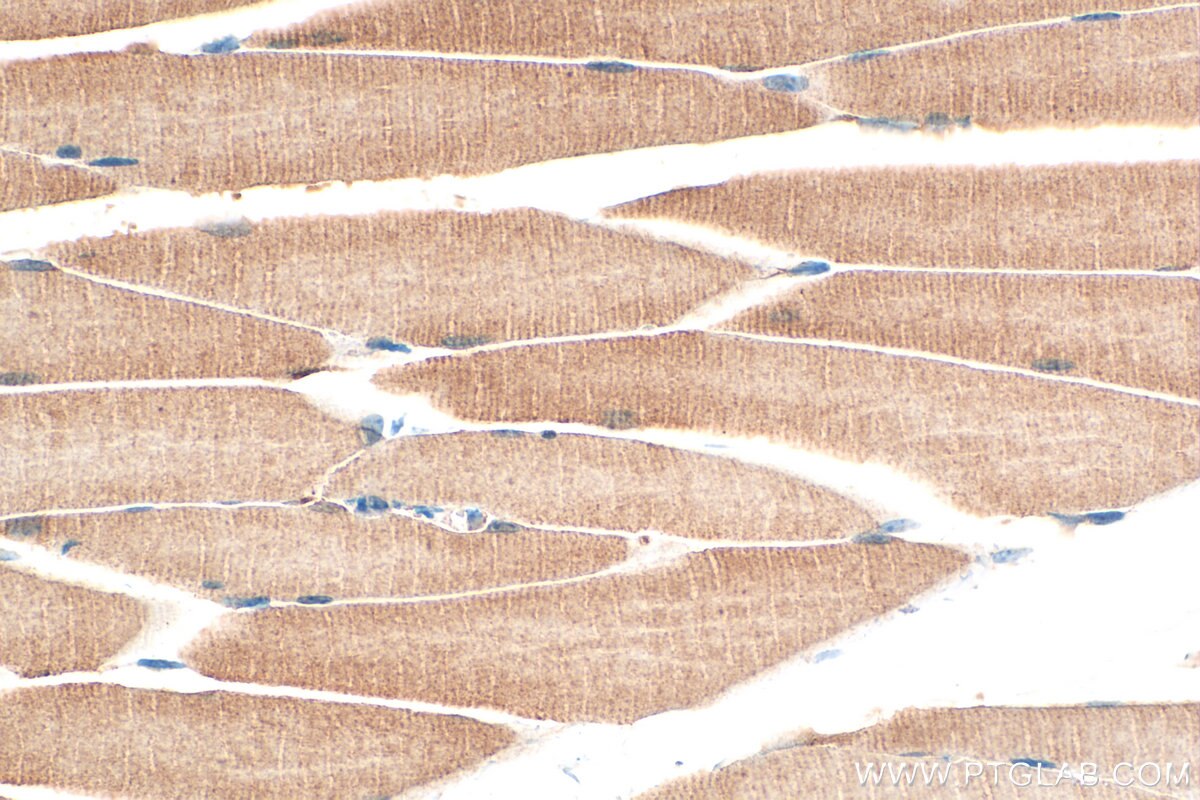 Immunohistochemistry (IHC) staining of mouse skeletal muscle tissue using DAPK2-Specific Polyclonal antibody (20048-1-AP)