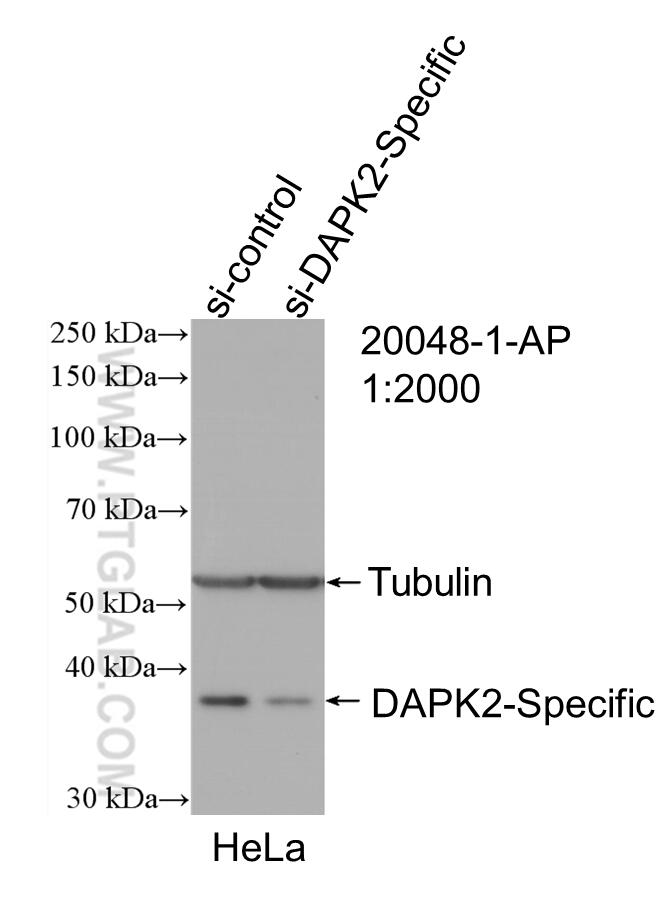Western Blot (WB) analysis of HeLa cells using DAPK2-Specific Polyclonal antibody (20048-1-AP)