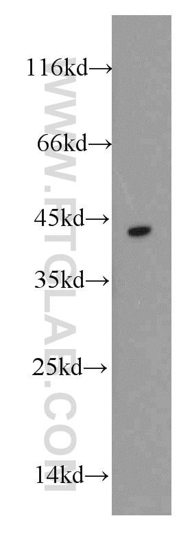 Western Blot (WB) analysis of A431 cells using DAPK2-Specific Polyclonal antibody (20048-1-AP)