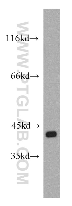 Western Blot (WB) analysis of A431 cells using DAPK2-Specific Polyclonal antibody (20048-1-AP)