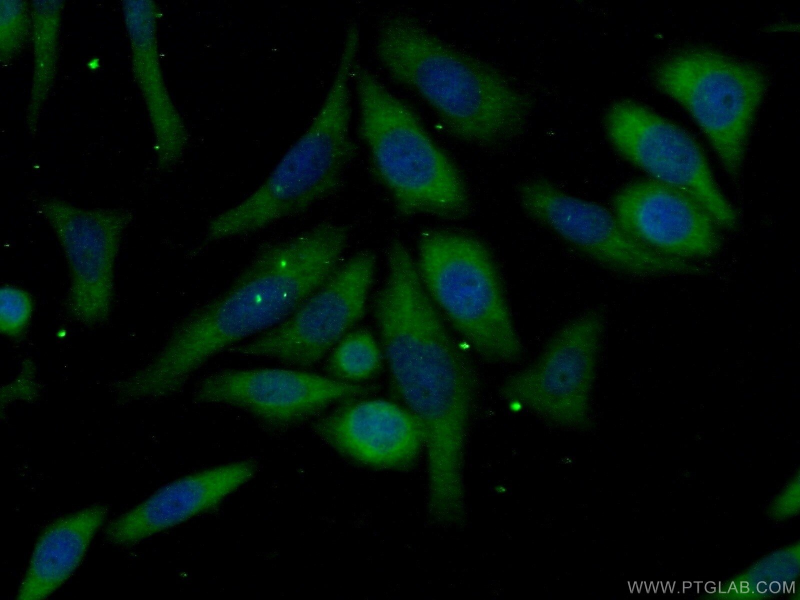 Immunofluorescence (IF) / fluorescent staining of HeLa cells using ZIP kinase Polyclonal antibody (19540-1-AP)