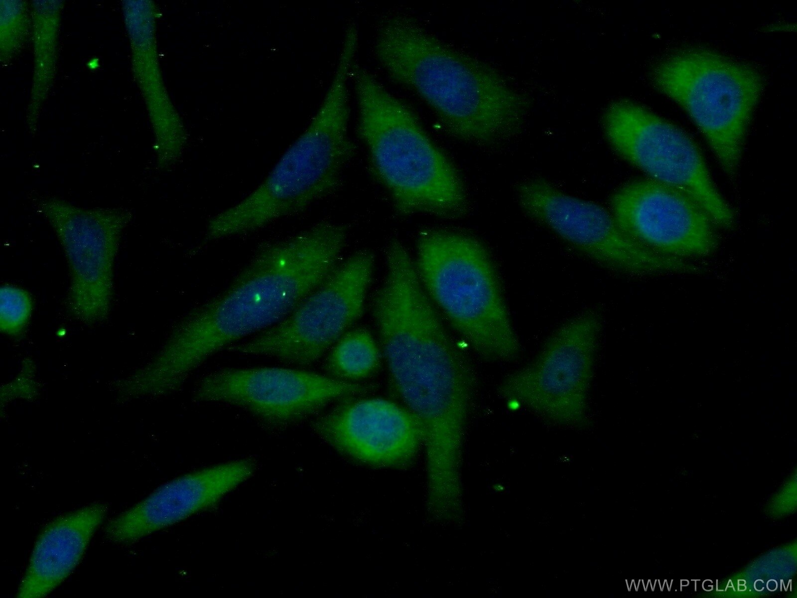 IF Staining of HeLa using 19540-1-AP